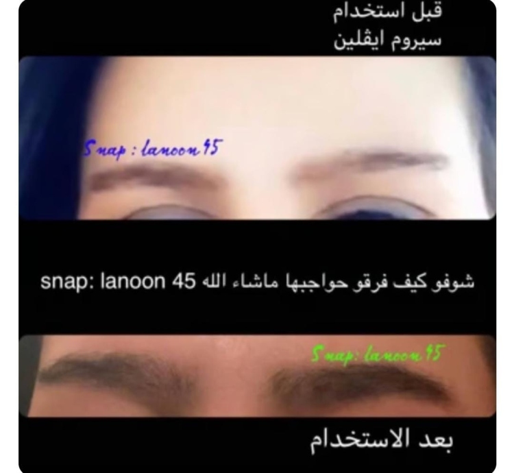 معالج ومقوي الرموش