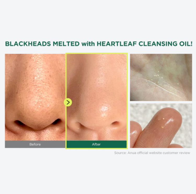 Anua, Heartleaf Pore Control Cleansing Oil 
