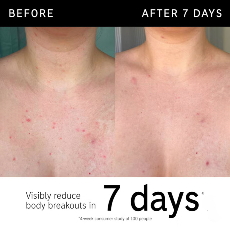 The INKEY List Glycolic Acid Exfoliating Body Stick 45g
