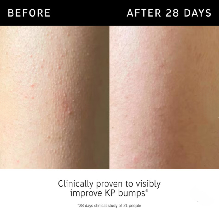 The INKEY List Glycolic Acid Exfoliating Body Stick 45g