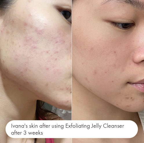 Hero Cosmetics, Clear Collective Exfoliating Jelly Cleanser  