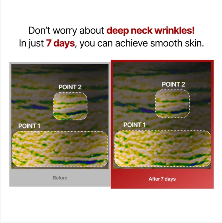 Meditherapy - Wrinkle-Fit Neck Mask Set 10g x 7 sheets 