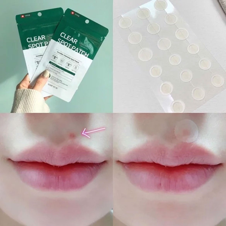  some by mi acne patches  لاصقات علاج الحبوب الموضعية