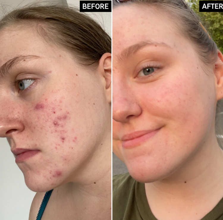 The Inkey List, Glycolic Acid Exfoliating Toner