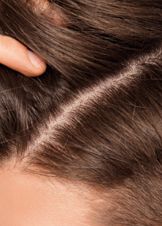 Babe, Anti-Oily Dandruff Shampoo