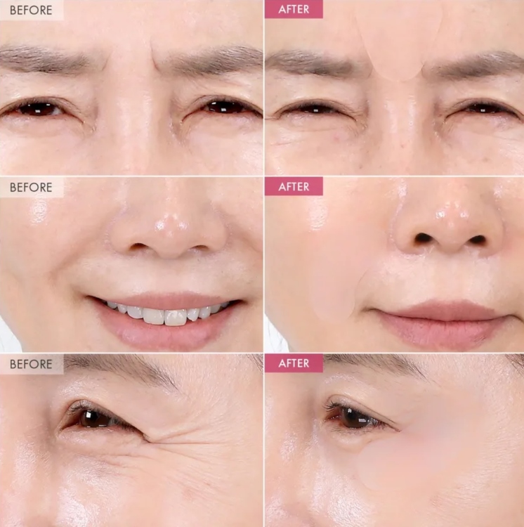 TOSOWOONG - SOS Intensive Magic Clinic Anti-Wrinkle Patch