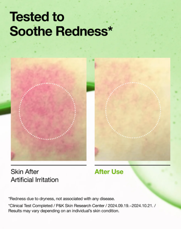 Anua, Azelaic Acid 10 Hyaluron Redness Soothing Serum