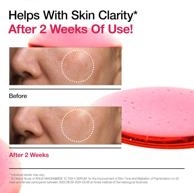 Anua, Niacinamide 10% + TXA 4% Dark Spot Correcting Serum