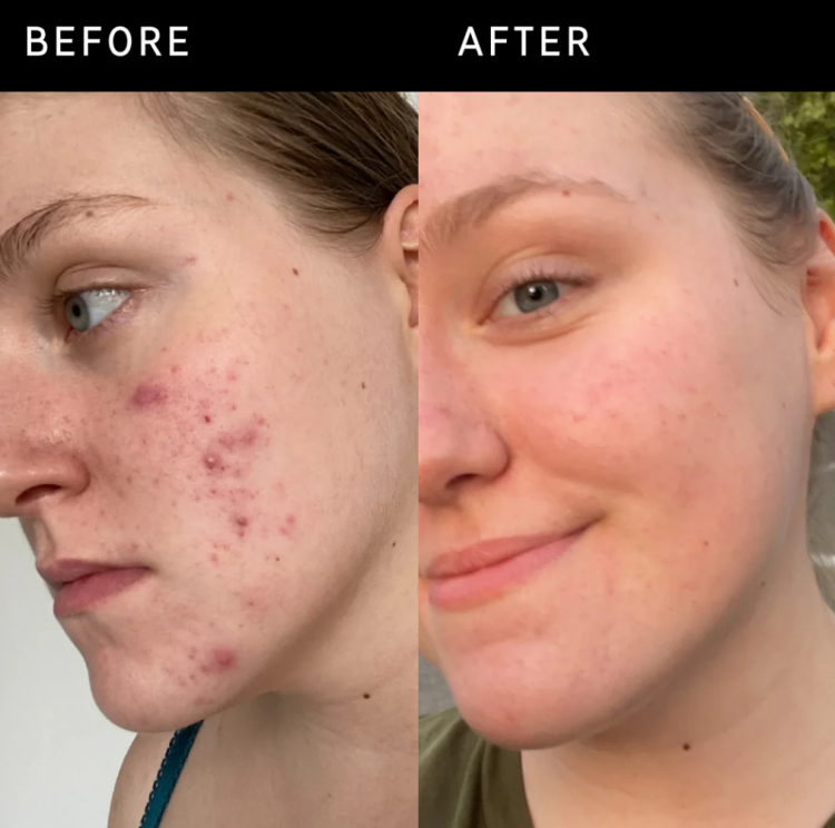 The INKEY List, 15% Vitamin C + EGF Serum