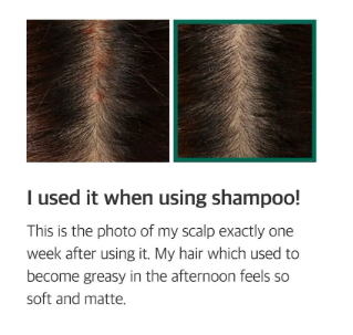SOME BY MI, 30 Days Miracle Tea Tree Clear Spot Oil