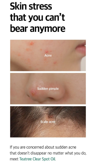 SOME BY MI, 30 Days Miracle Tea Tree Clear Spot Oil
