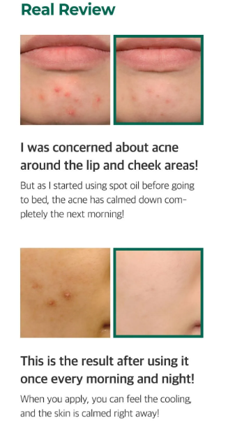 SOME BY MI, 30 Days Miracle Tea Tree Clear Spot Oil