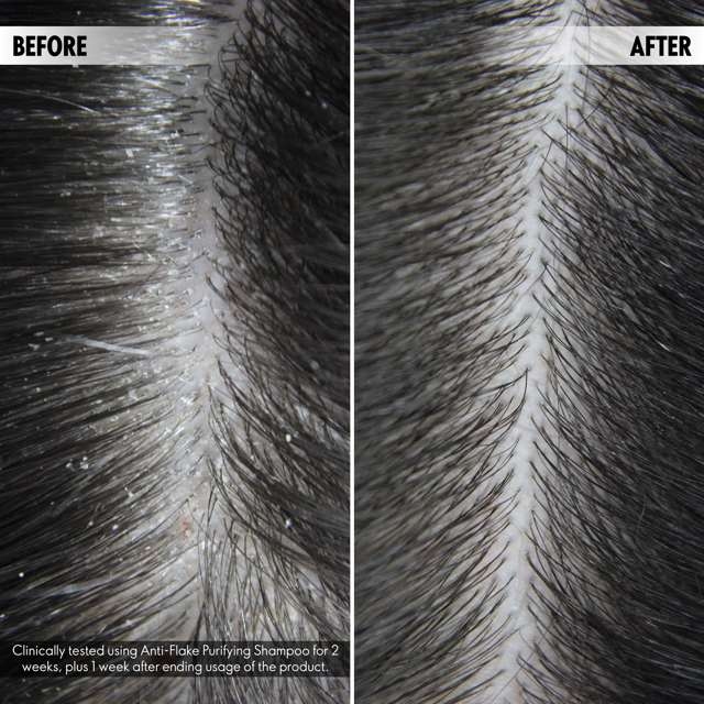 44951 250  ml. DUOLOGI Anti-Flake Purifying Shampoo