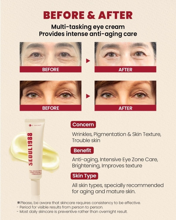 KSECRET - SEOUL 1988 Eye Cream : Retinal Liposome 4% + Fermented Bean