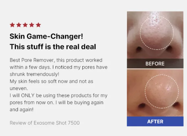 medicube, One Day Exosome Shot Pore Ampoule 2000