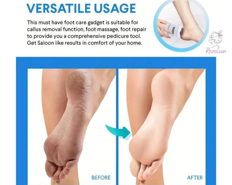 Foot Cleaning-Versatile Usage(ازالة مسمار اللحم و الجلد الميت )