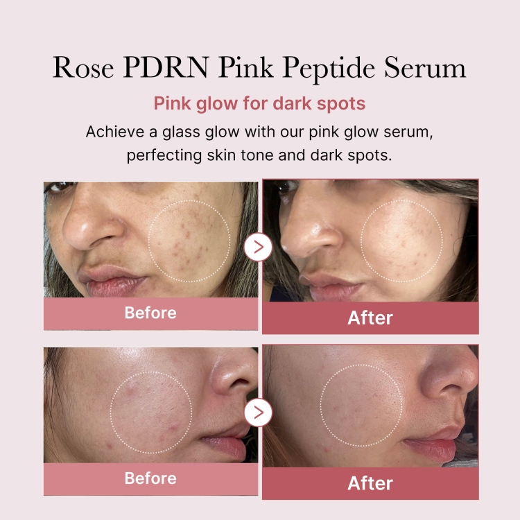 Medicube, PDRN Pink Peptide Serum