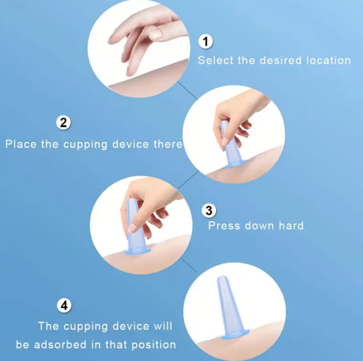 4pcs Silicone Facial Cupping Set