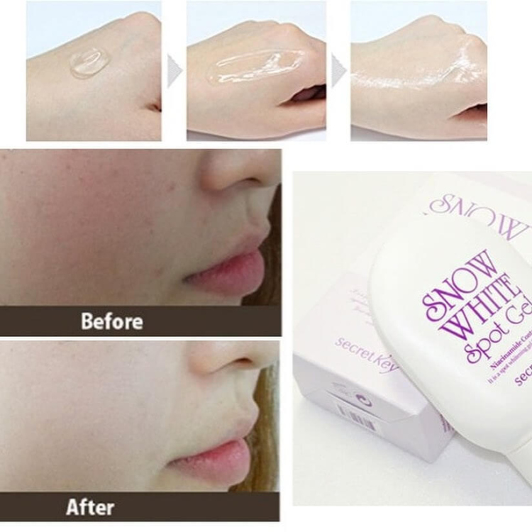 secret key snow white spot gel ❄️جل التفتيح الكوري الشهير سنو وايت