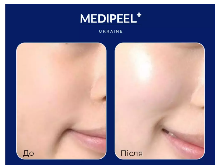 MEDI-PEEL, Mela+Tox Ampoule