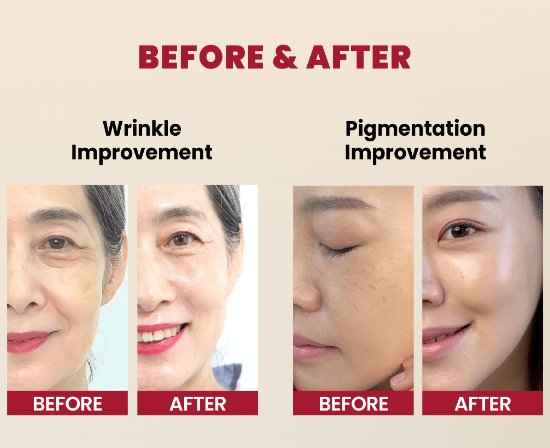 KSECRET, SEOUL 1988 Serum : Retinal Liposome 2% + Black Ginseng
