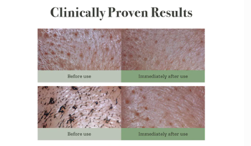 FULLY, Green Tomato Clay Pack Cleanser