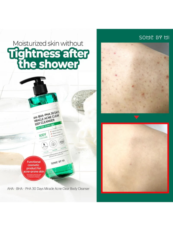 SOME BY MI AHA BHA PHA 30 Days Miracle Body Cleanserغسول الجسم المعجزة لعلاج حبوب الجسم 