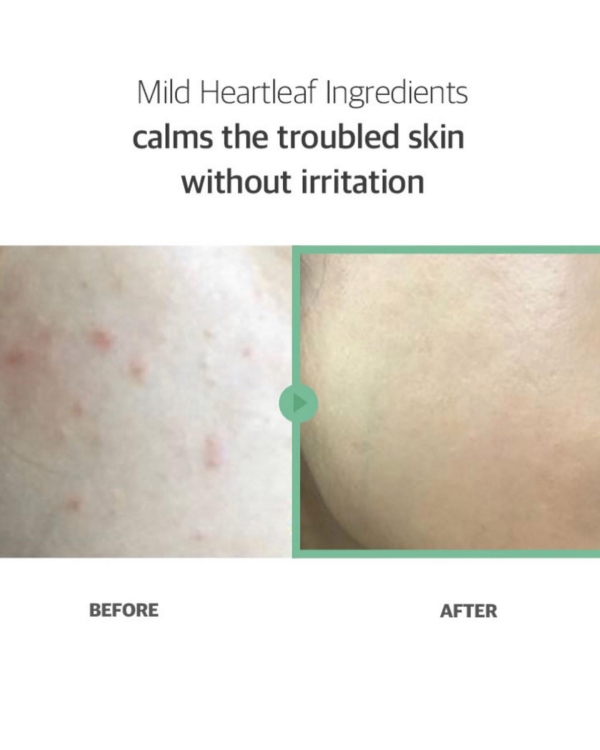 celimax - JIWOOGAE Heartleaf BHA Peeling Pad /60pads