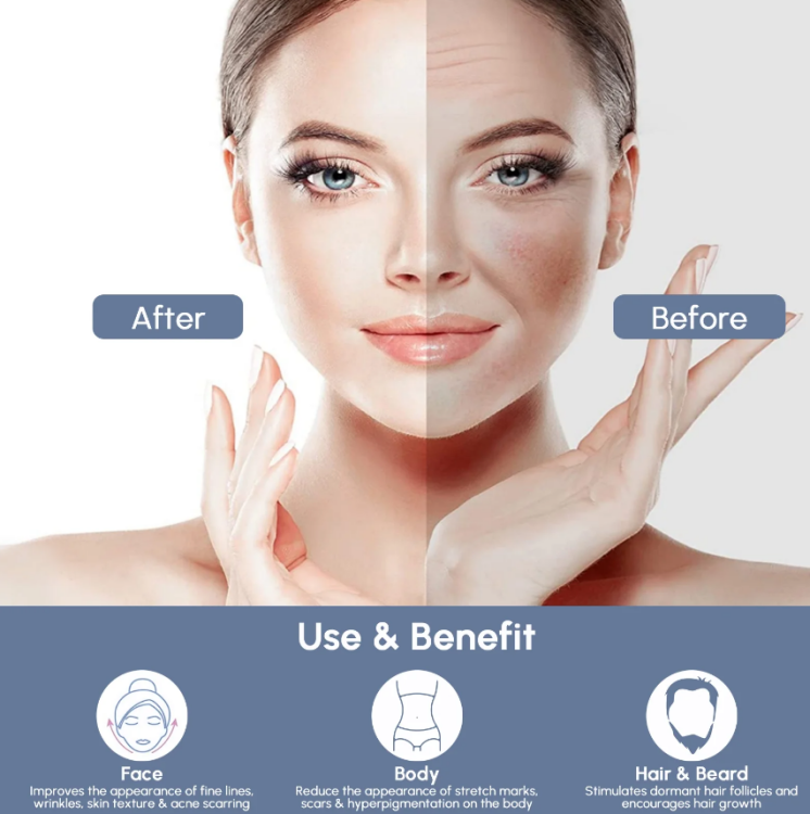 DRS, Adjustable Microneedling Derma Stamp