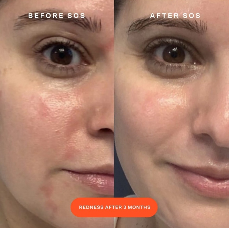 Tower 28 Beauty, SOS Daily Rescue Facial Spray