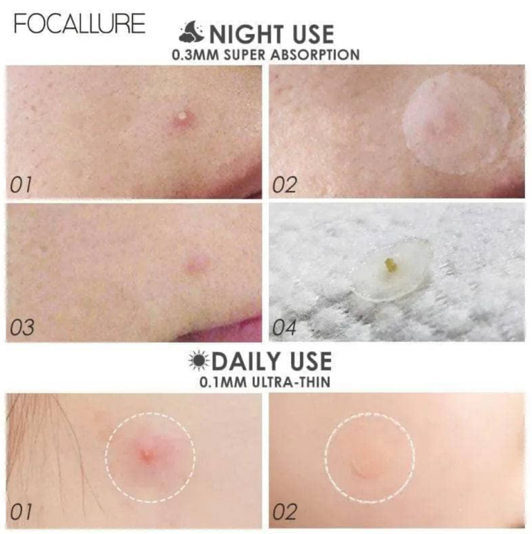 FOCALLURE, Acne Pimple Patch - Night 