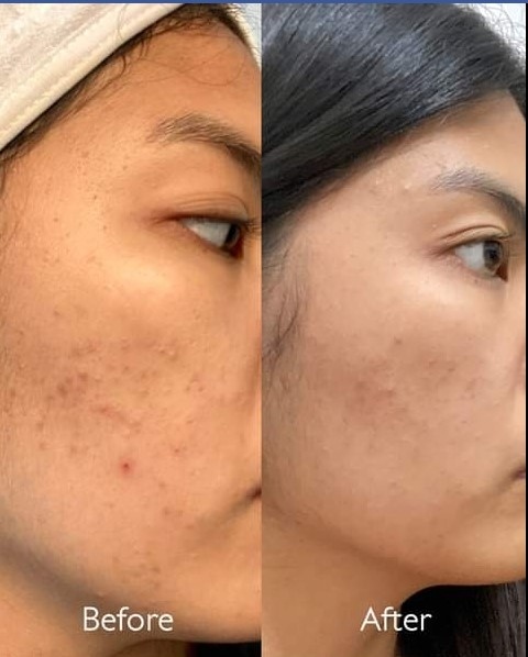 Caudalie, Vinoperfect Radiance Serum Complexion Correcting 