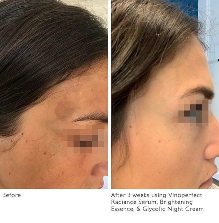 Caudalie, Vinoperfect Radiance Serum Complexion Correcting 