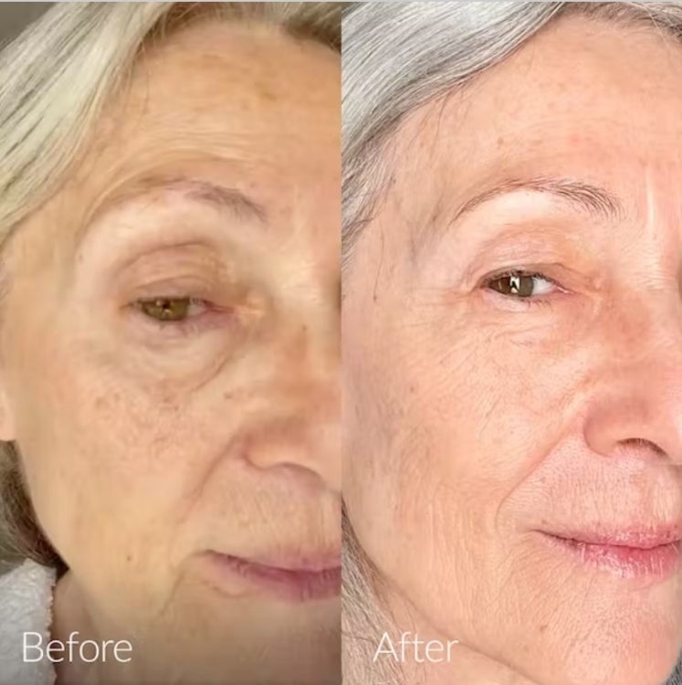 Caudalie, Vinoperfect Radiance Serum Complexion Correcting 