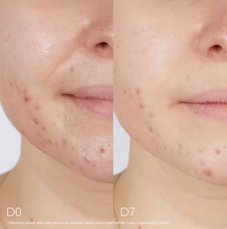 Caudalie, Vinopure Blemish Control Infusion Skin Perfecting Serum سيروم التحكم بالحبوب و المسام و الرؤوس السوداء  