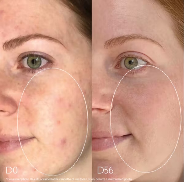 Caudalie, Vinopure Blemish Control Infusion Skin Perfecting Serum سيروم التحكم بالحبوب و المسام و الرؤوس السوداء  