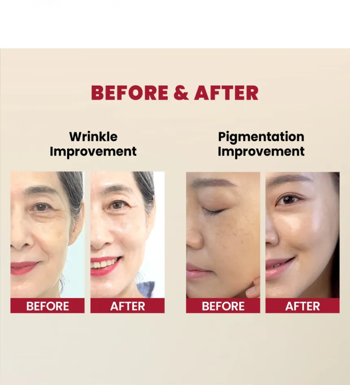 KSECRET - SEOUL 1988 Serum : Retinal Liposome 2% + Black Ginseng /30ml