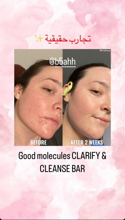 Good Molecules, Clarify & Cleanse Bar