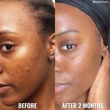Good molecules GENTLE RETINOL CREAM، كريم الريتينول اللطيف
