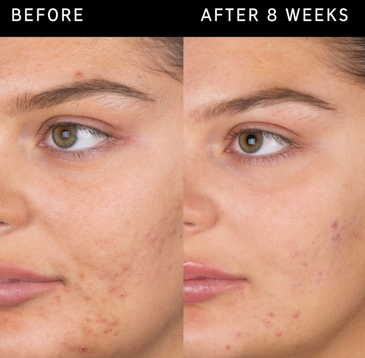 The Inkey List, Salicylic Acid Cleanser