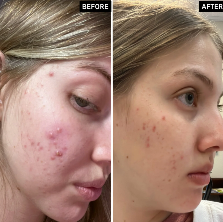 The Inkey List, Salicylic Acid Cleanser