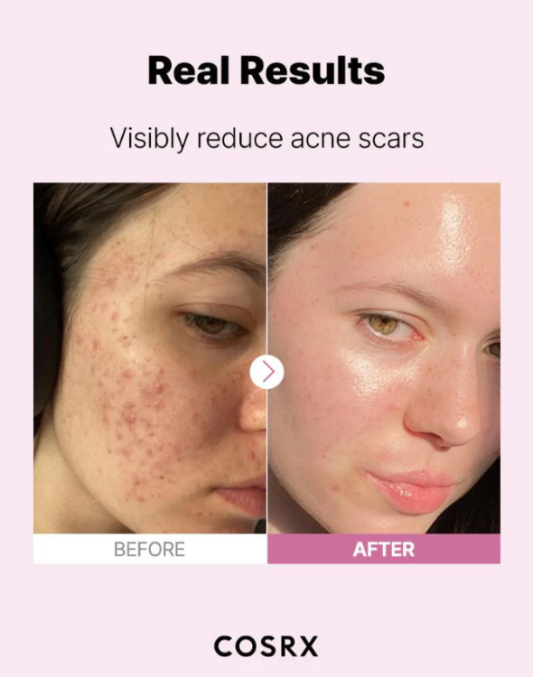 COSRX, The Niacinamide 15 Serum