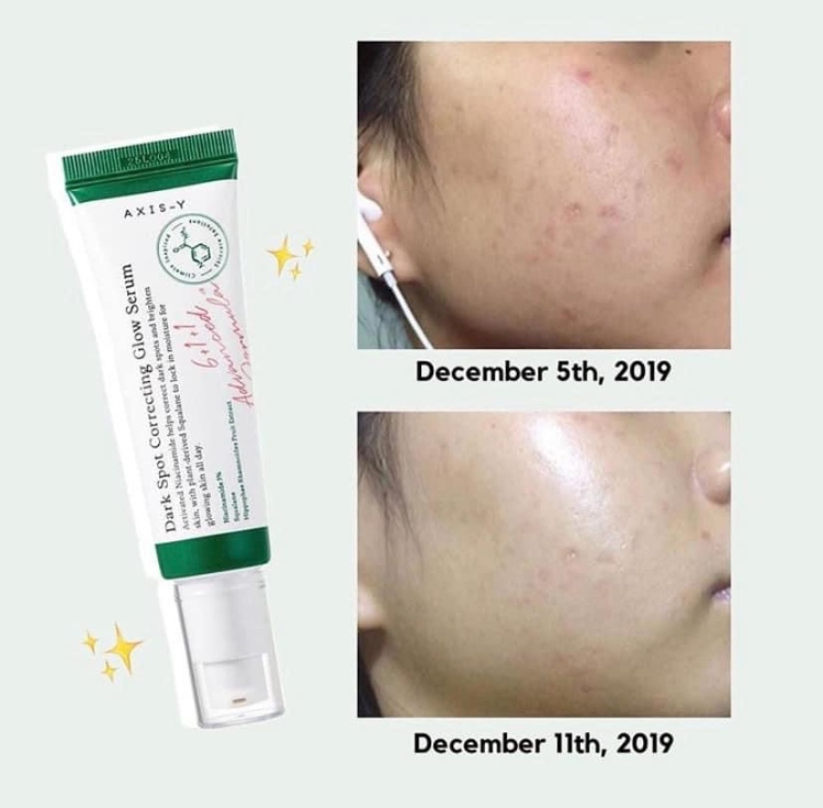 AXIS-Y Dark Spot Correcting Glow Niacinamide سيروم النياسيناميد لتصبغات والتفتيح والنضاره