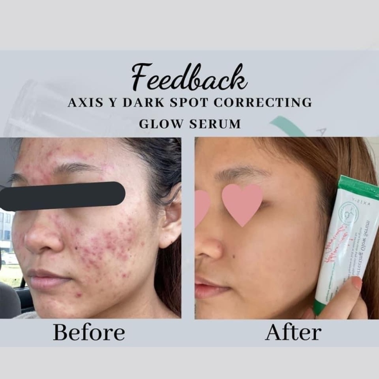 AXIS-Y Dark Spot Correcting Glow Niacinamide سيروم النياسيناميد لتصبغات والتفتيح والنضاره