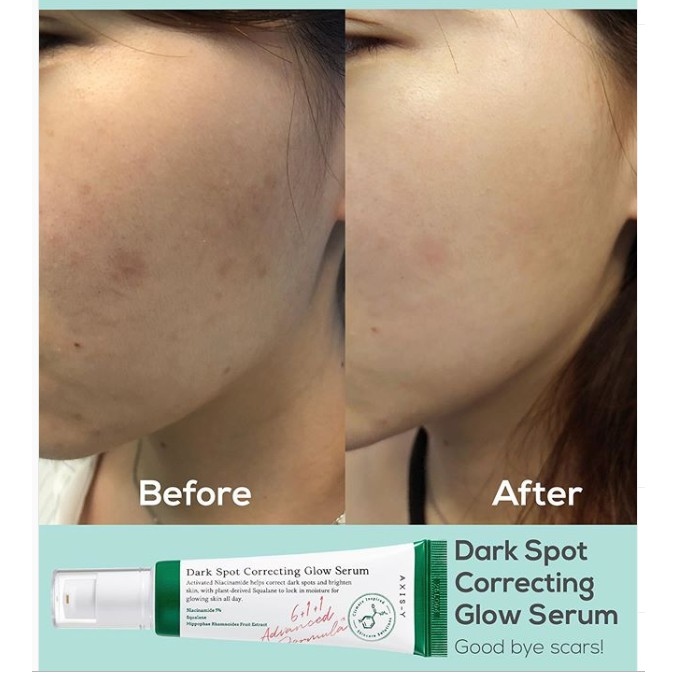 AXIS-Y Dark Spot Correcting Glow Niacinamide سيروم النياسيناميد لتصبغات والتفتيح والنضاره